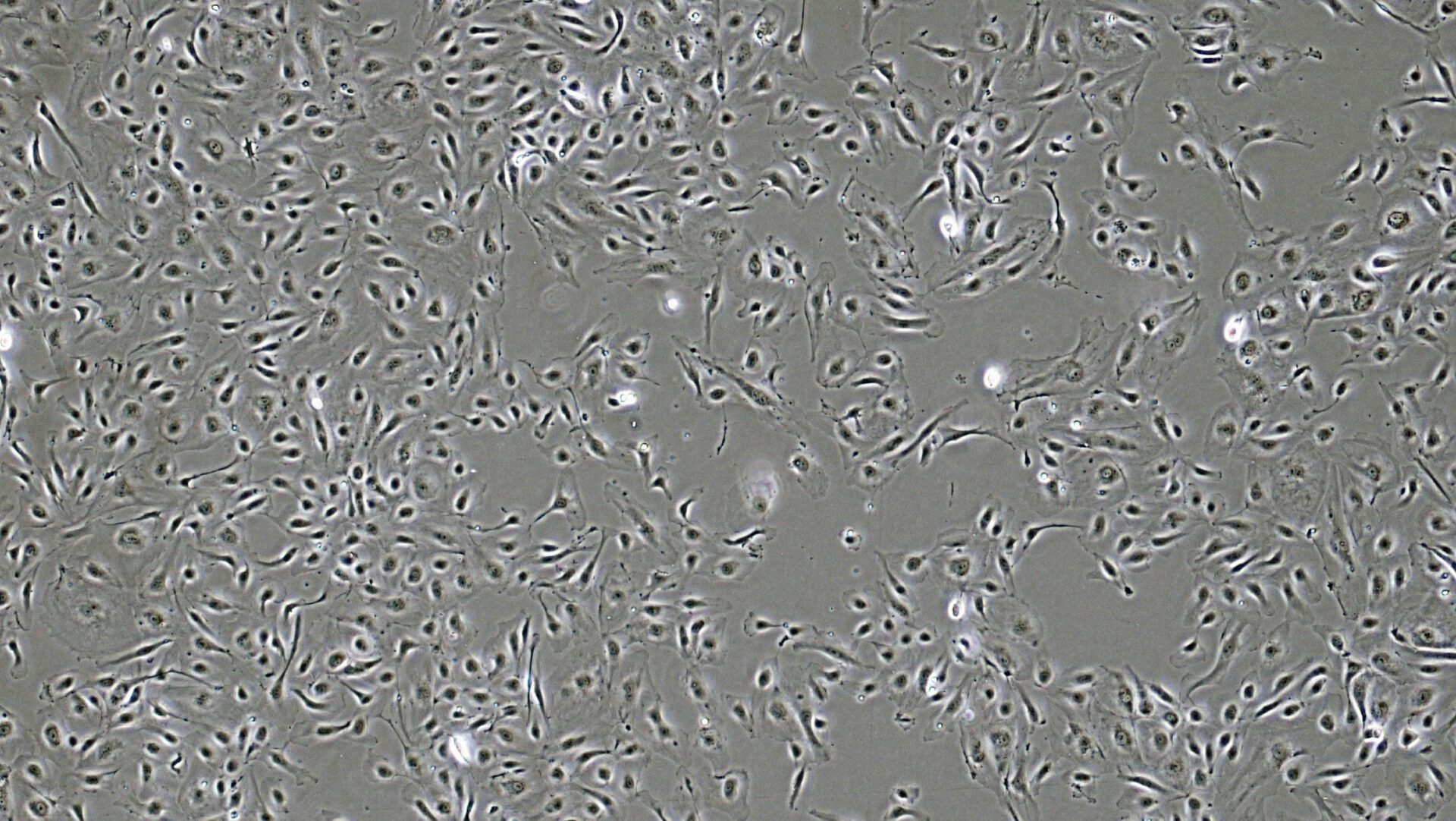 Micrograph of HUVECs