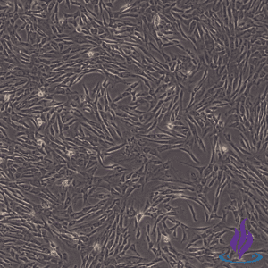 MSCs, Mesenchymal Stromal Cells